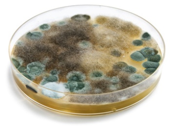 Mold home test kit